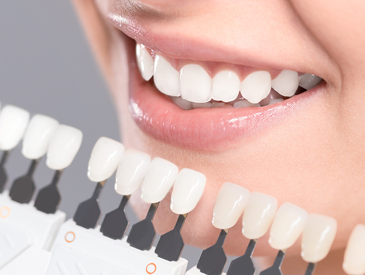 ESTÉTICA DENTAL