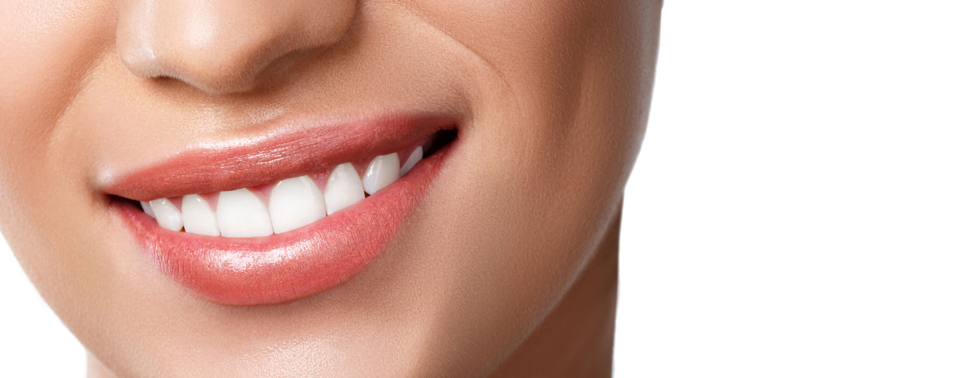 Estética dental