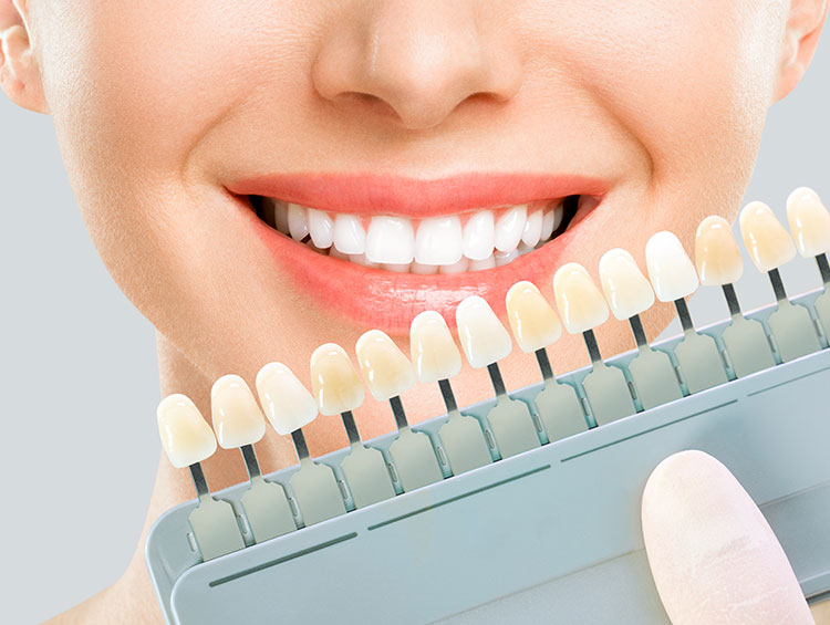 ESTÉTICA DENTAL