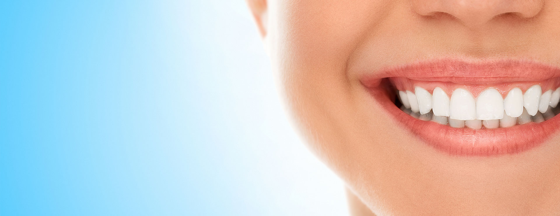 Estética dental